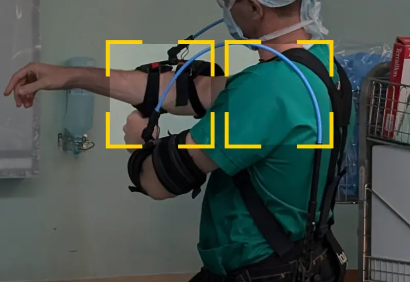 Focus on arm and shoulder pain for a surgeon